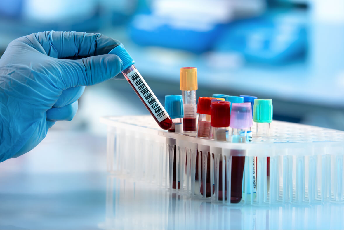 Phlebotomy Technician